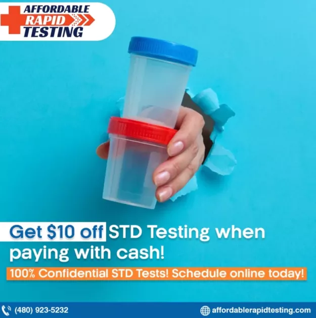 Std test,more commonly known as stds,std testing,chlamydia and gonorrhea testing,affordable rapid testing