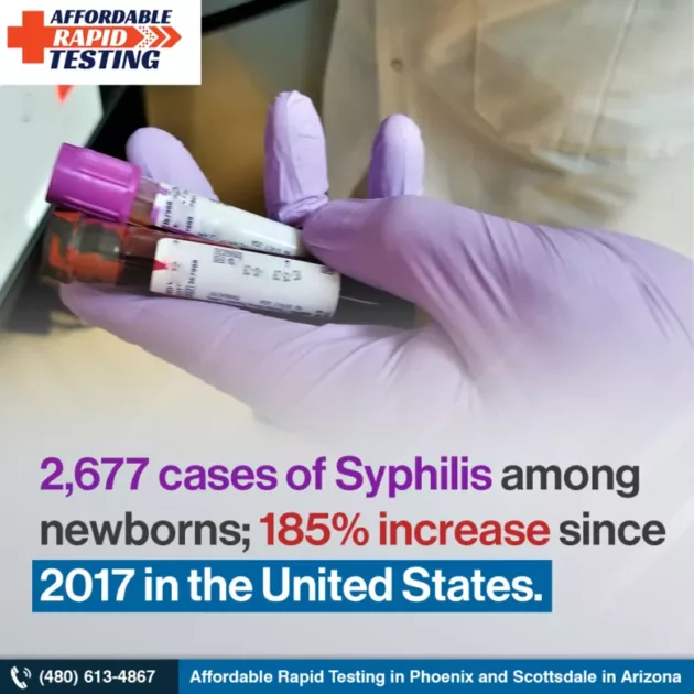 Std,std testing,getting sti test,reliable std testing