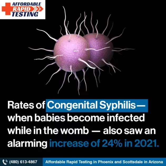 Std testing,sti testing,gonorrhea,chlamydia,hiv testing,genital herpes,hpv,affordable rapid testing,stds