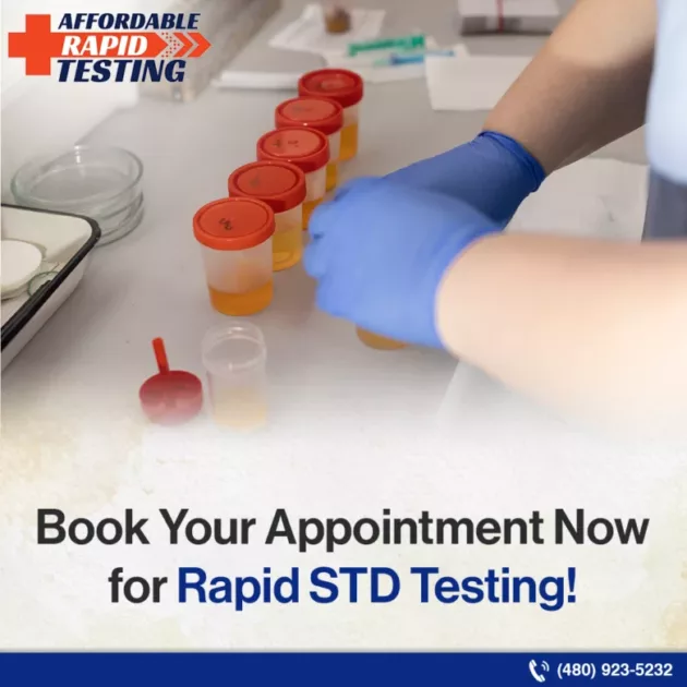 Std testing,same-day std testing,std testing near me,affordable rapid testing center near me,rapid std test