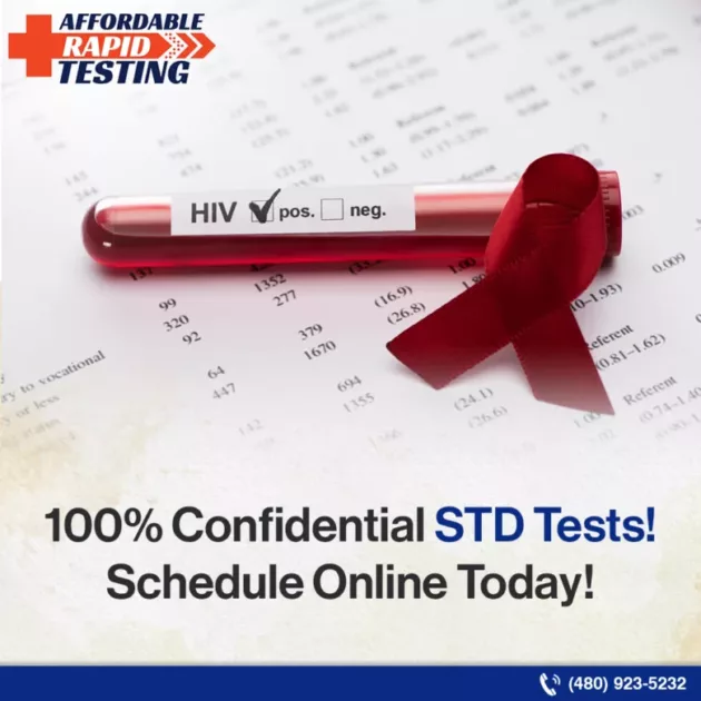 Stds,symptoms of stds,types of stds,std testing,std testing service,std tests near me