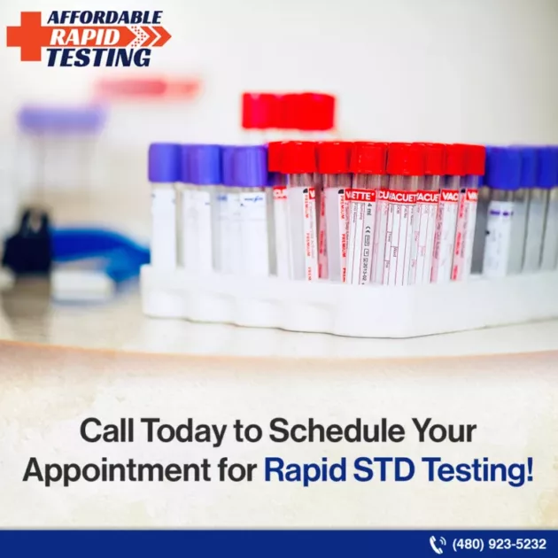Std tests,confidential std testing,private std tests,std testing clinics,reliable std testing center