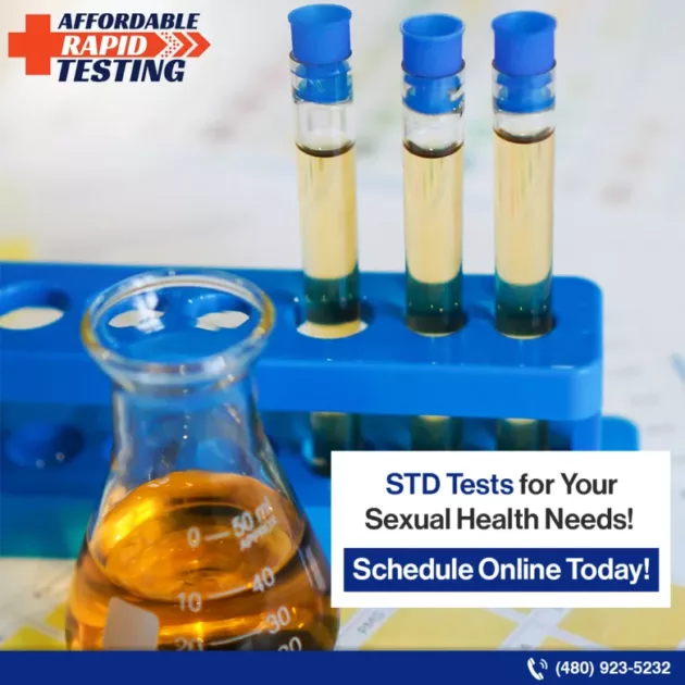 Std tests,common stds,stds tests near me,affordable rapid testing