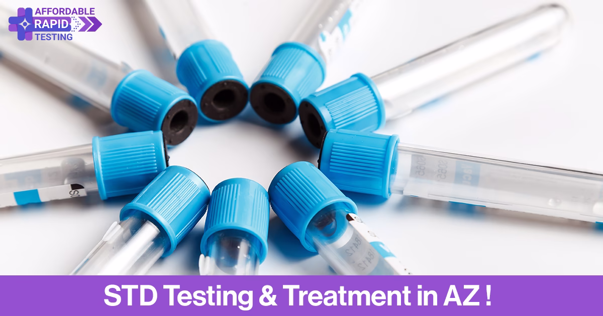 Std testing,affordable rapid testing,most common stds,full-panel std testing,std tests